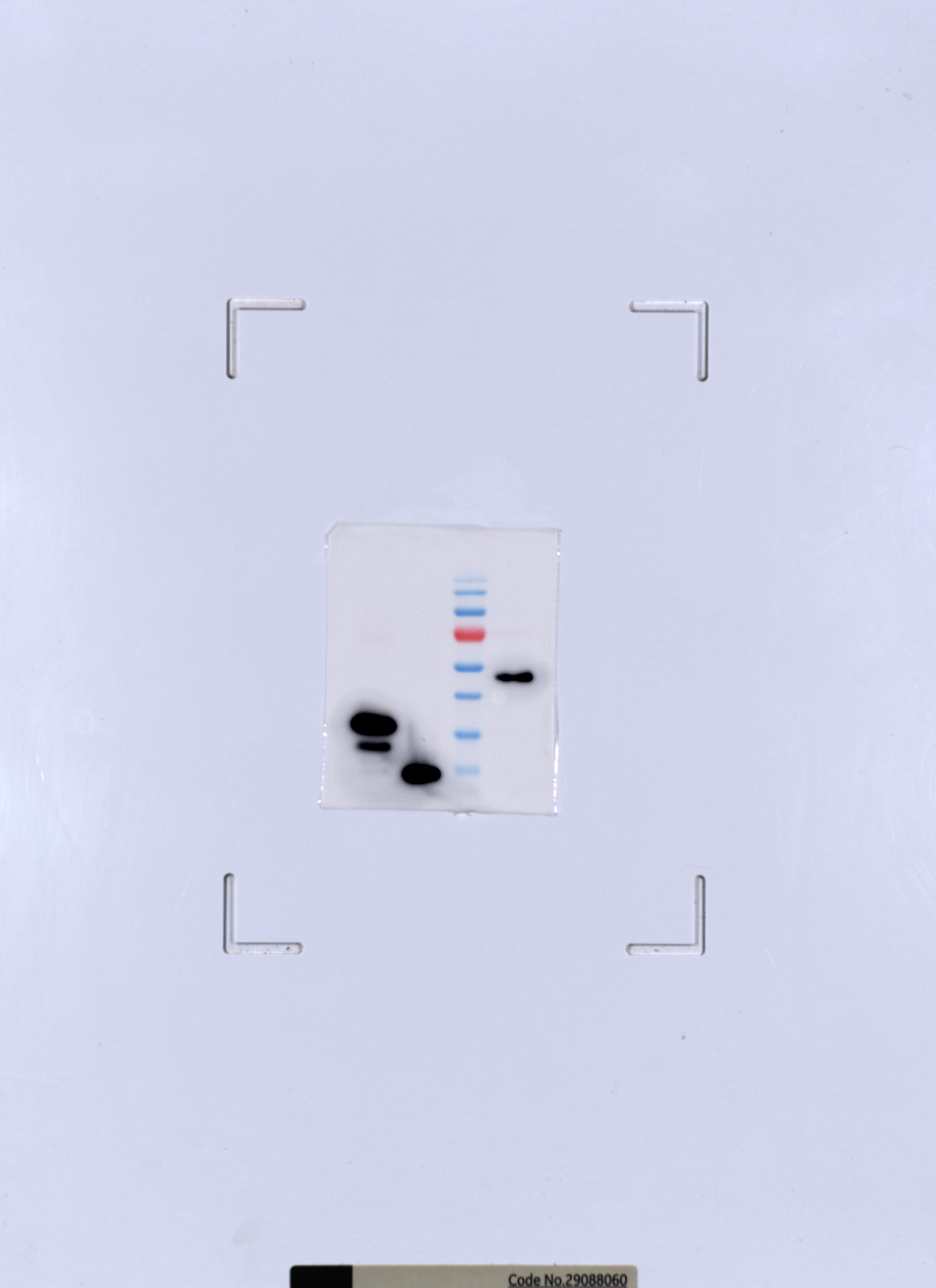 protein x ray diffraction pattern polymerase ii