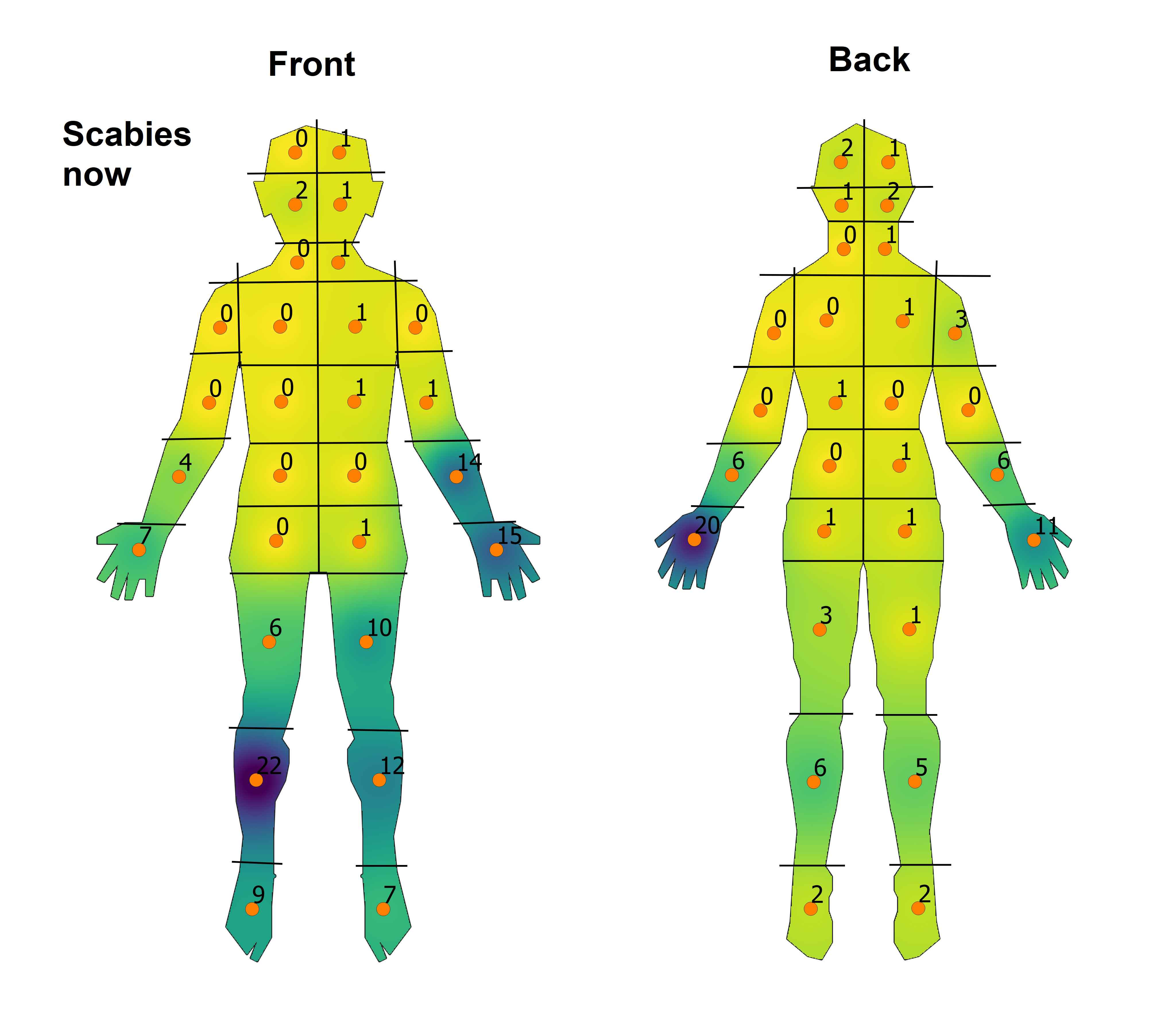 Body distribution of impetigo and association with host and pathogen ...